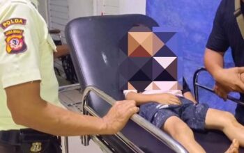 Monyet Liar Kembali Renggut Korban di Cianjur, Bocah 6 Tahun Terluka Parah