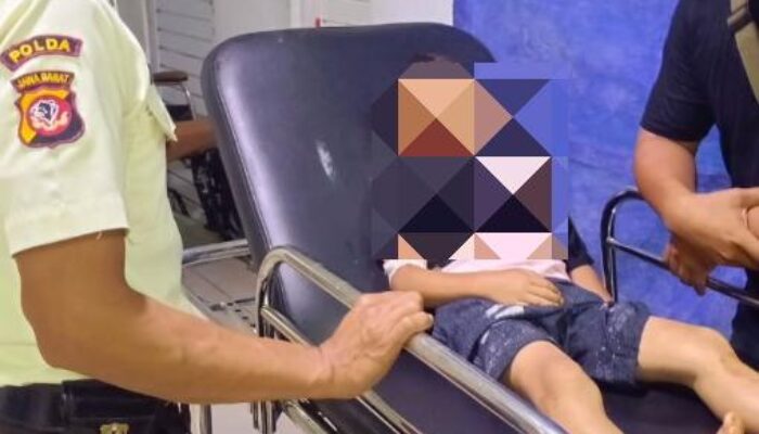 Monyet Liar Kembali Renggut Korban di Cianjur, Bocah 6 Tahun Terluka Parah